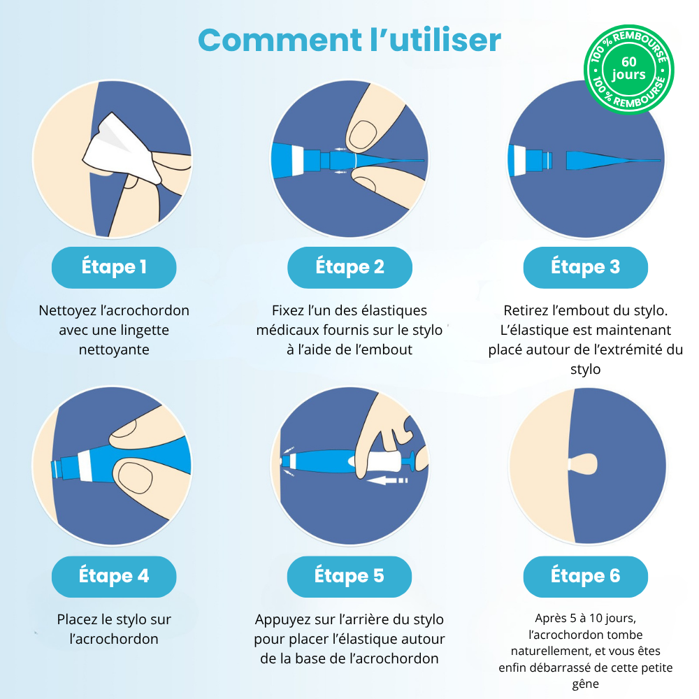 Kit TagPen™ | Retirez vos acrochordons facilement, en toute sécurité, à la maison | -50 %