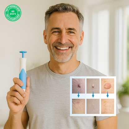 Kit TagPen™ | Retirez vos acrochordons facilement, en toute sécurité, à la maison | -50 %